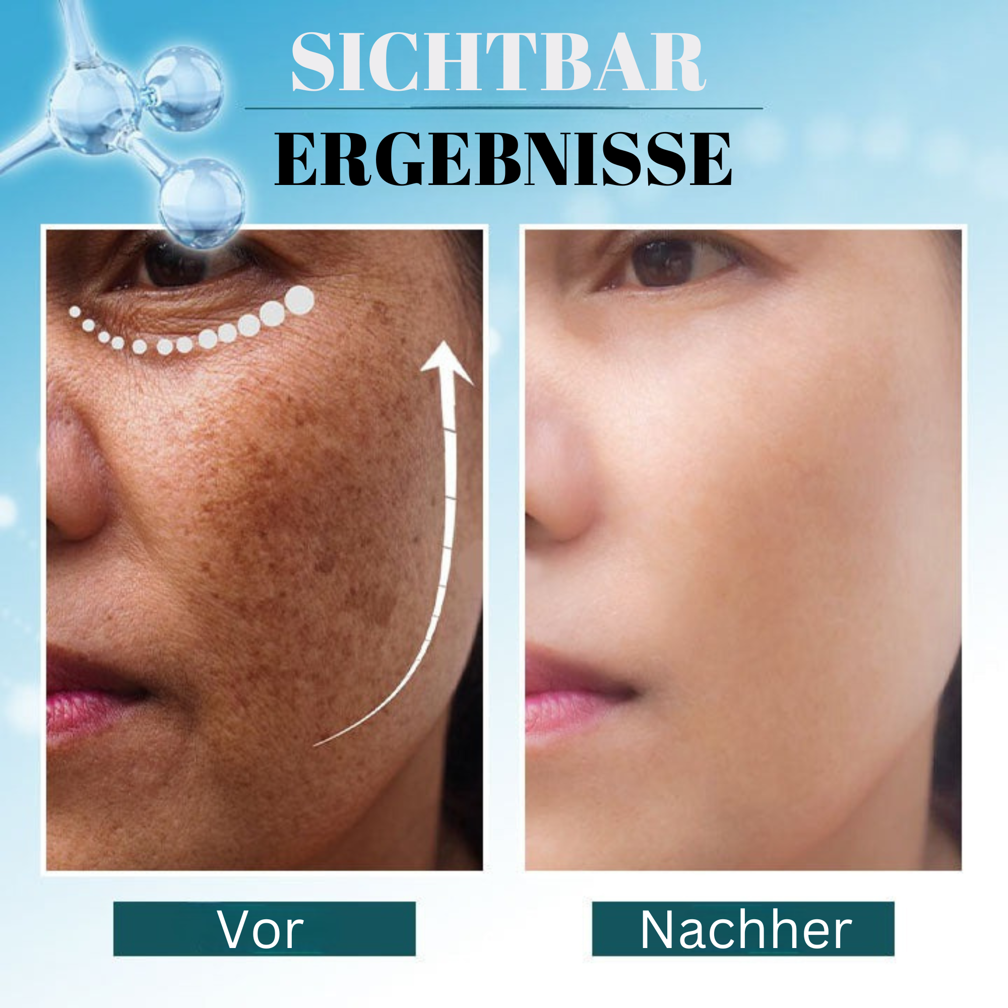 Spotless™️ I Korrektor zum Entfernen dunkler Flecken