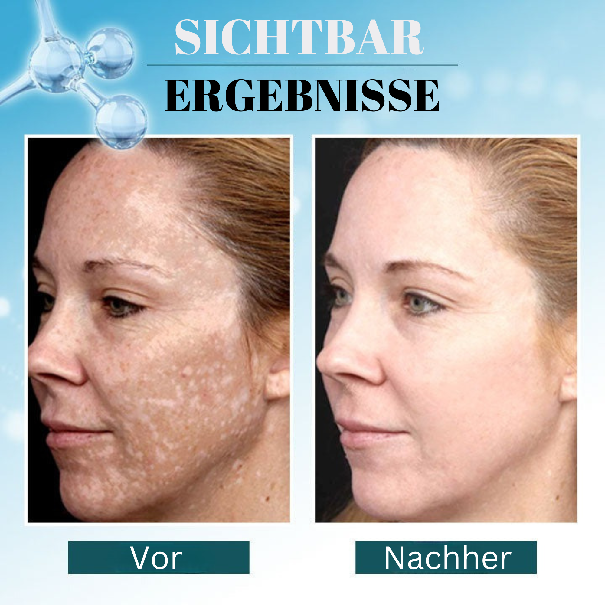 Spotless™️ I Korrektor zum Entfernen dunkler Flecken