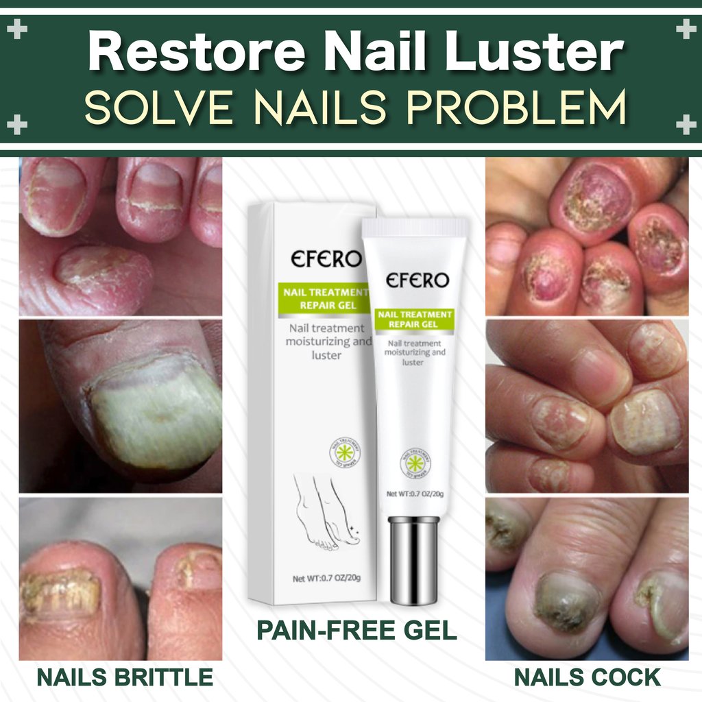 Toe Be Health™ Nagelreparaturgel