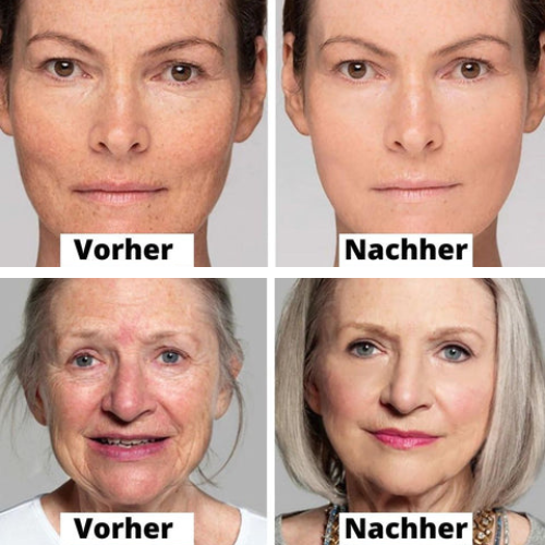 AntiAge™ - Waschfreie Kollagen Gesichtsmaske (10+10 GRATIS)