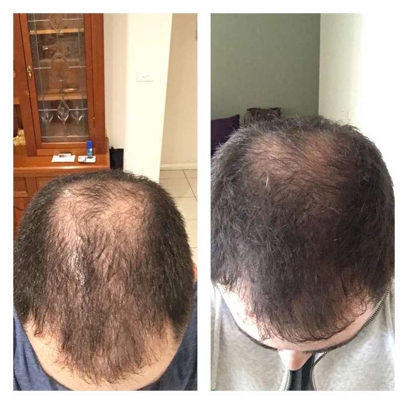 HairBar™ - Anti-Haarausfall Reis Shampoo Bar