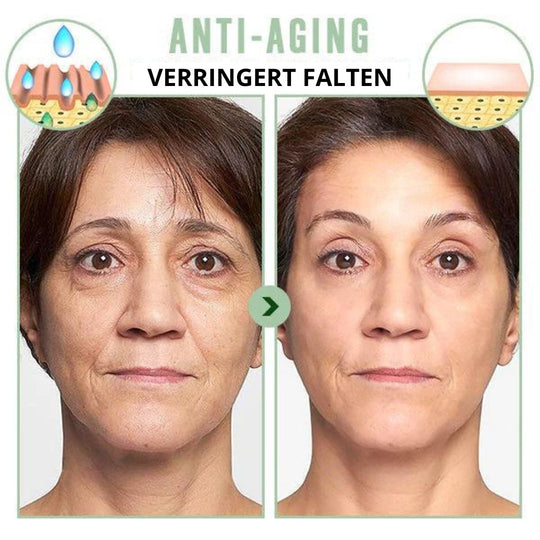 AntiAge™ - Waschfreie Kollagen Gesichtsmaske (10+10 GRATIS)