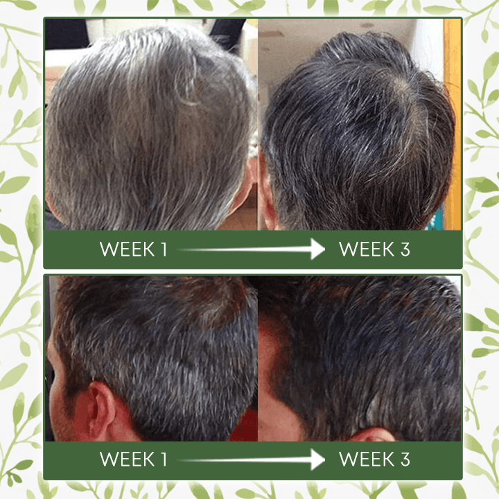 Herbal Heal™ Pflanzliches Shampoo zur Haarverdunkelung