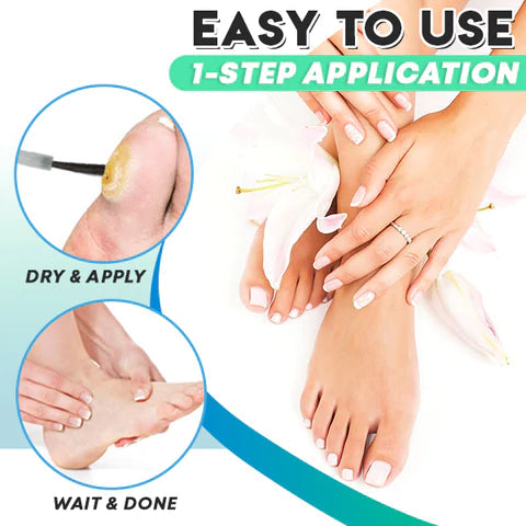 Corn Gel™ Gel zur Entfernung von Mais (1+1 GRATIS)