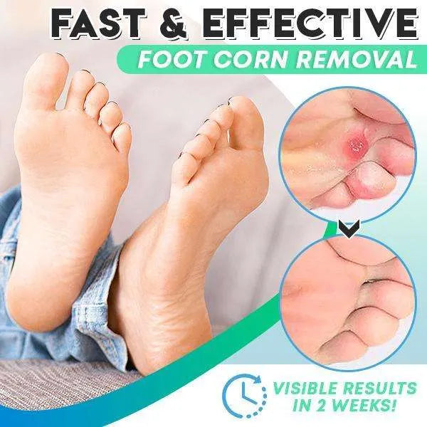 Corn Gel™ Gel zur Entfernung von Mais (1+1 GRATIS)