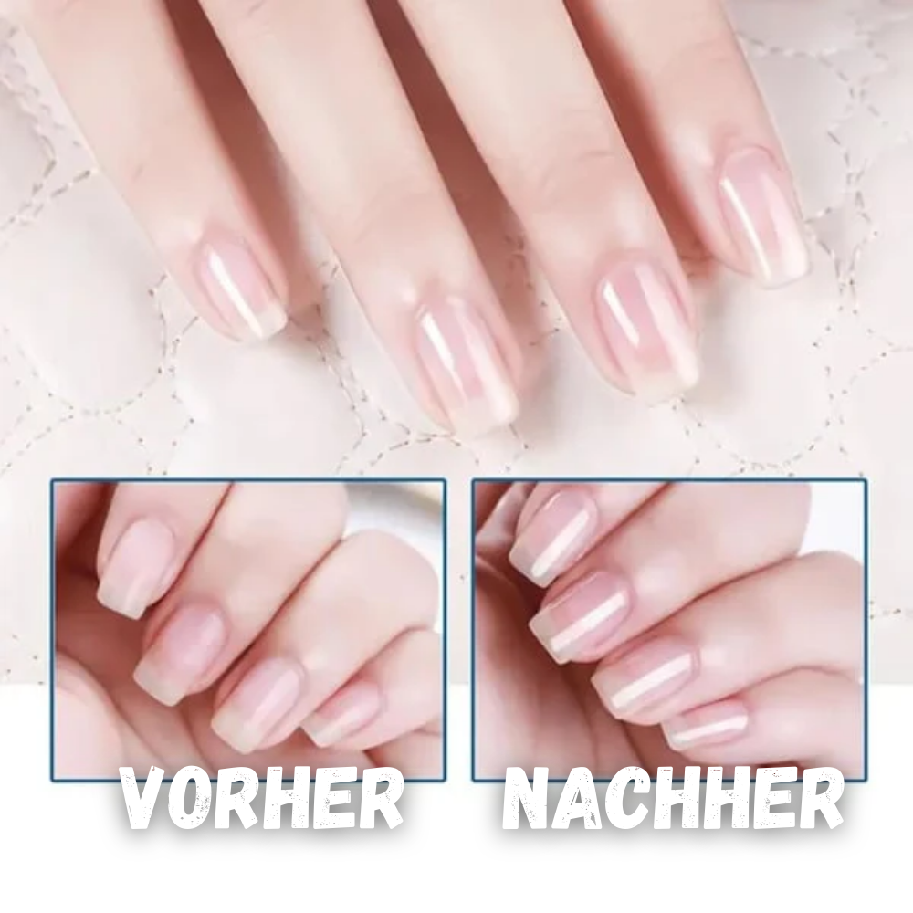 NailRevive™ - Nagelpflegeöl