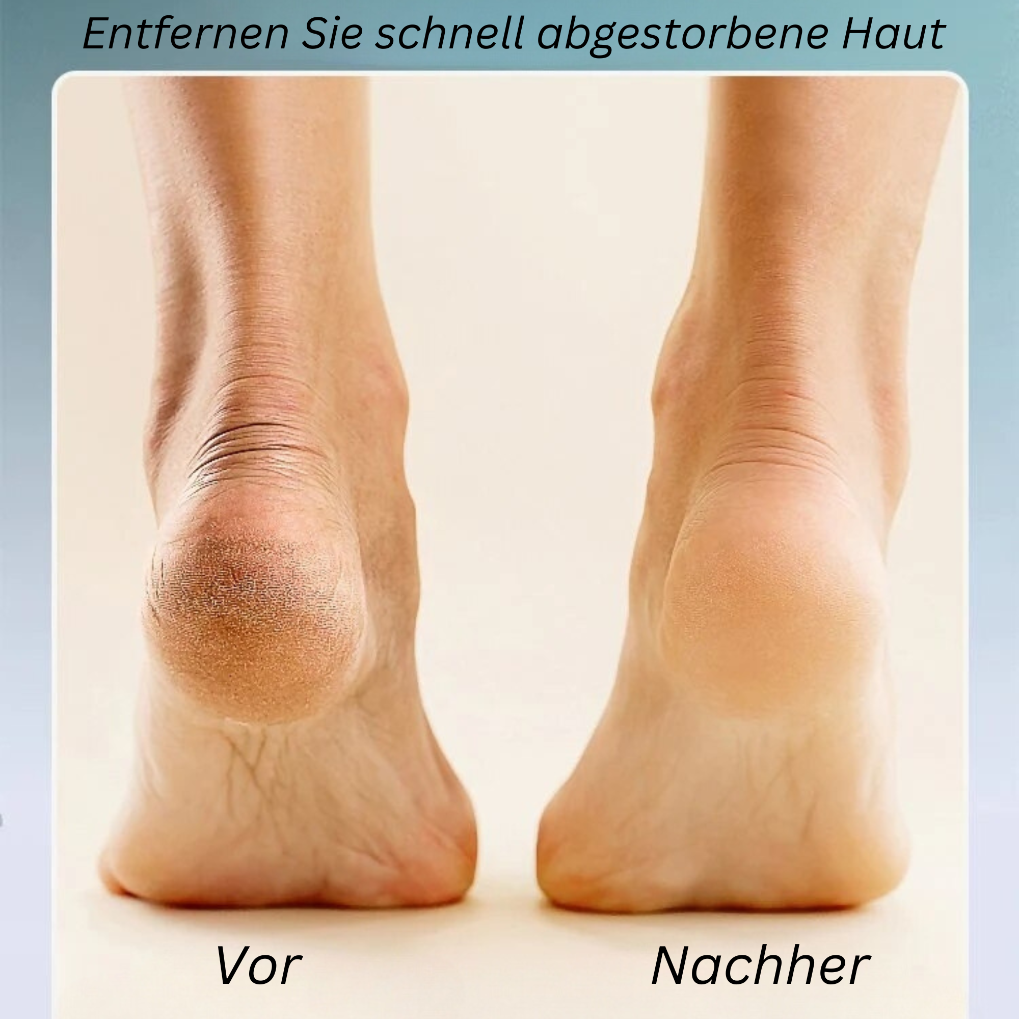 PediCare™️ I Elektrischer Fußschwielenentferner