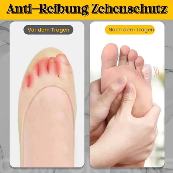 ToeSaver™ Anti-Reibung Zehenschutz (20 Stück Satz)