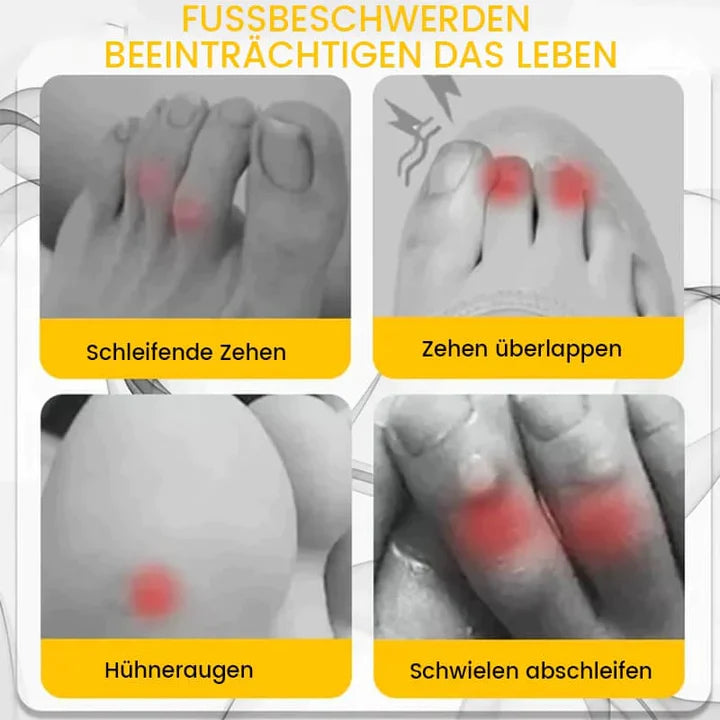 ToeSaver™ Anti-Reibung Zehenschutz (20 Stück Satz)