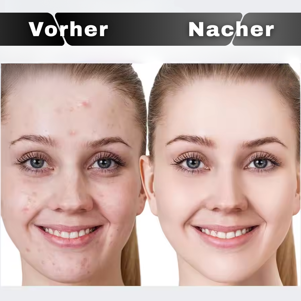 Liftara™ - Gesichtsmassager