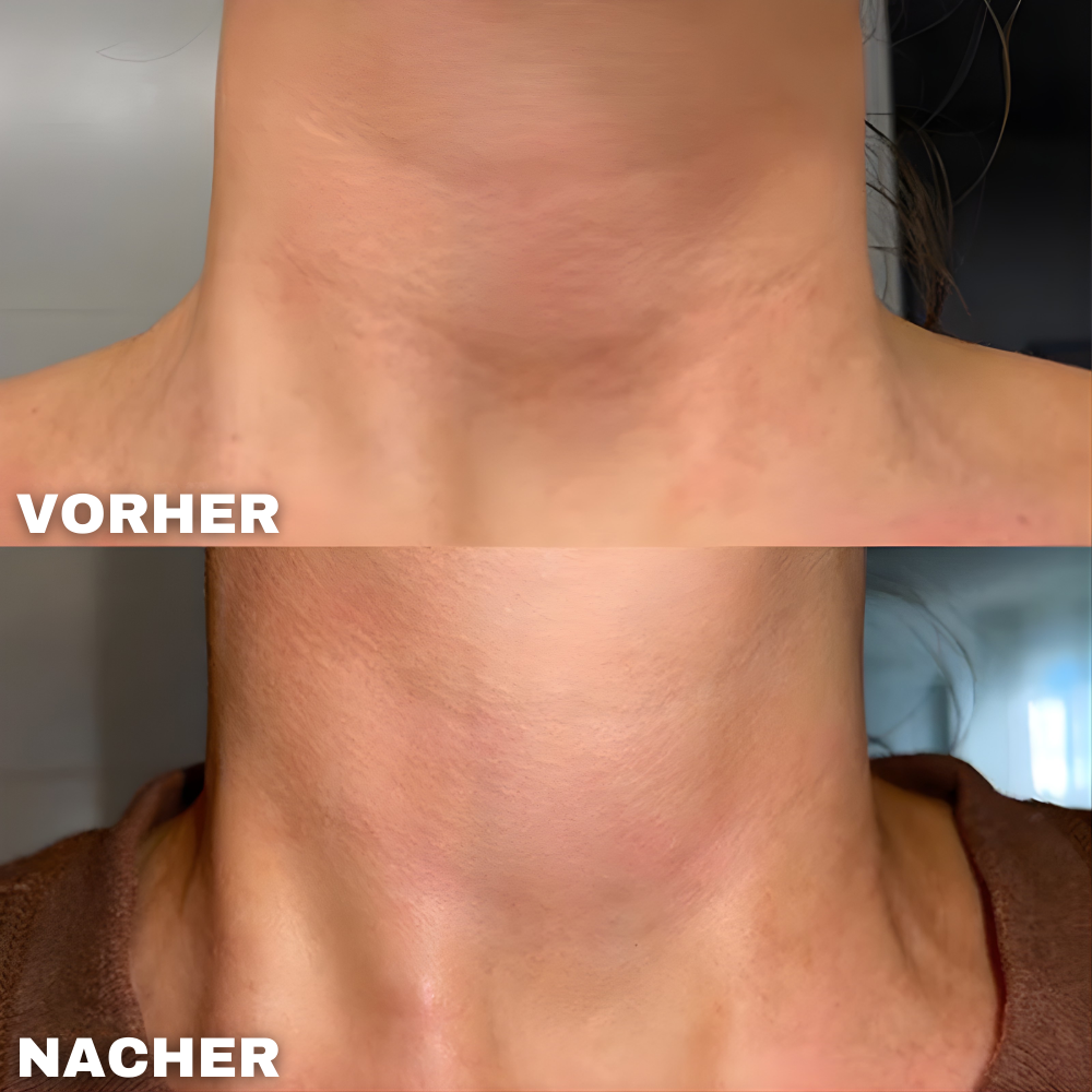 SilkNape™ - Wiederverwendbares Silikon Hals Glättungspad (1+1 GRATIS)
