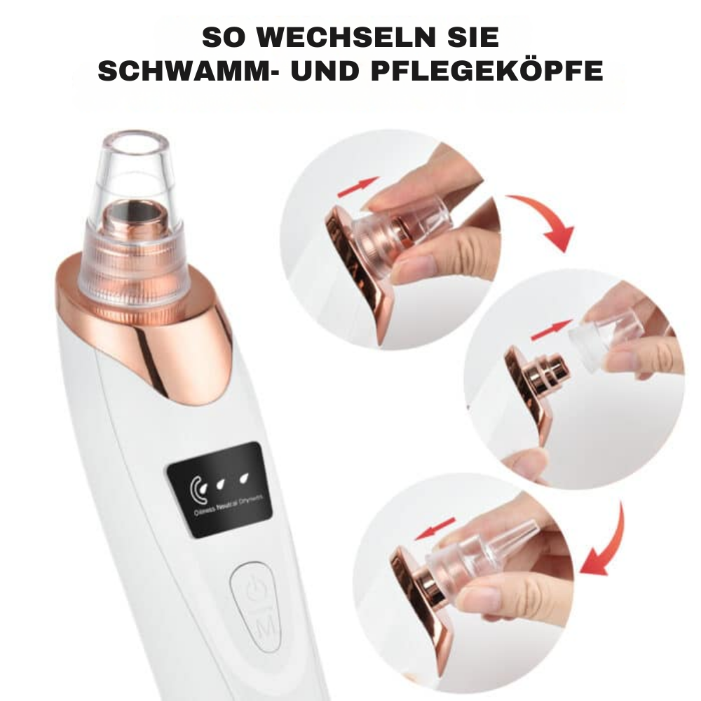 PoreLuxe™ - Gesichts Mitesser Entferner Vakuum