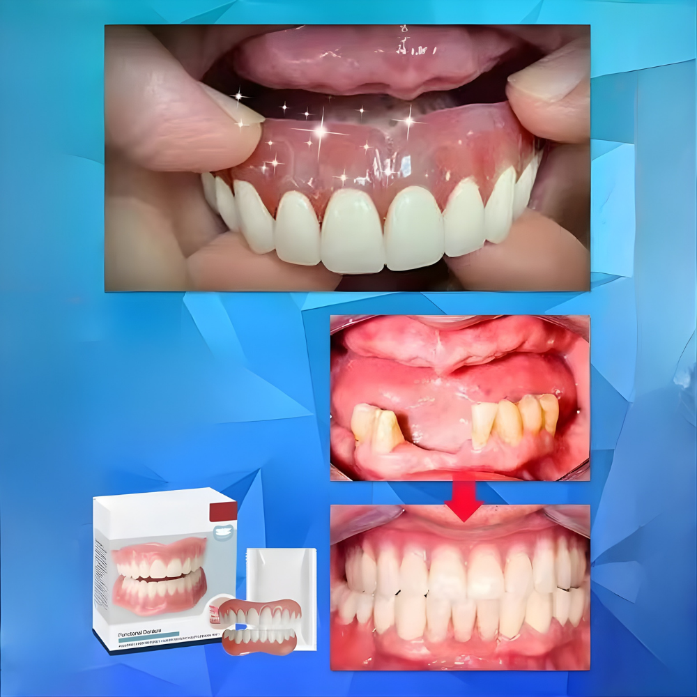 Dentivo™ - Schnappprothese Satz