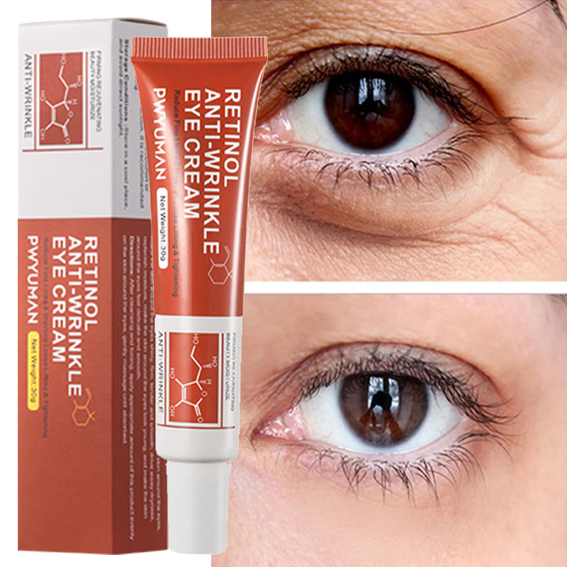 LuminEyes™ - Retinol Anti-Falten Augencreme (1+1 GRATIS)