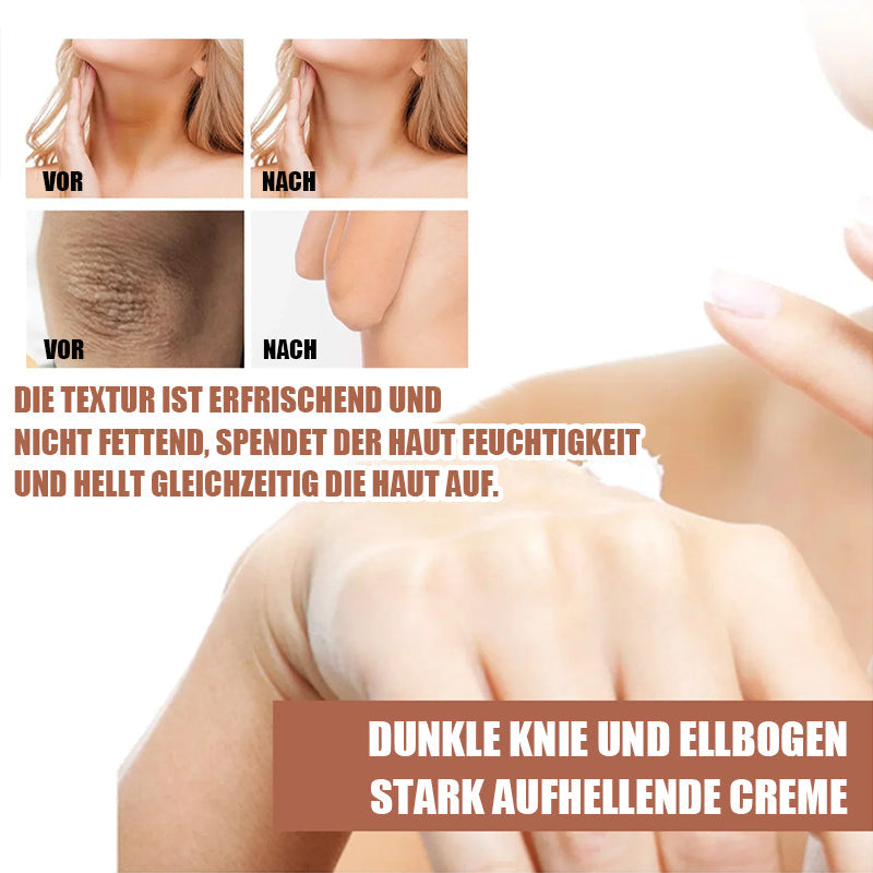 EELHOE™ Dunkle Kreise Aufhellende Creme (1+1 GRATIS)