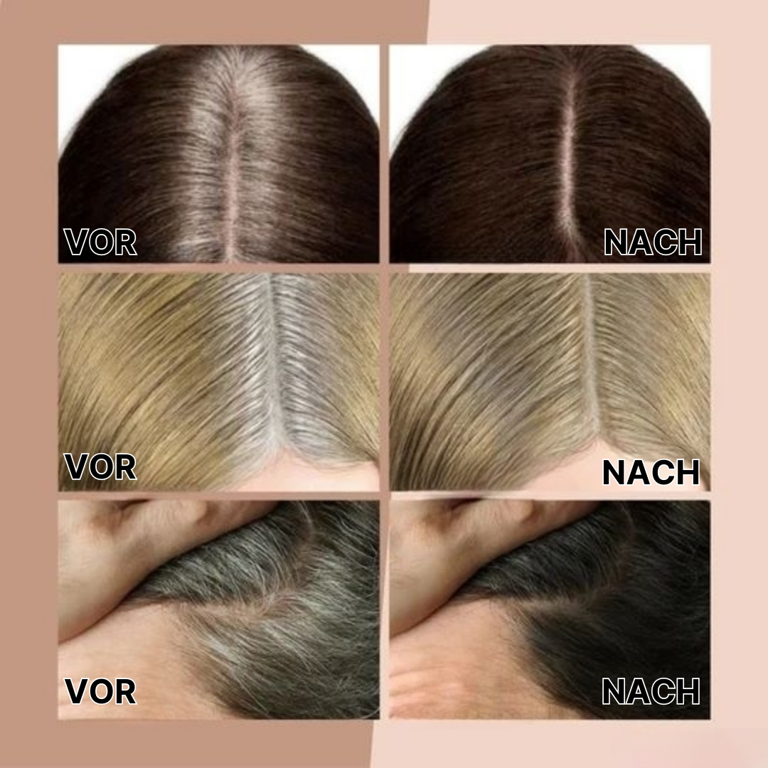 HairHue™ Haarlinien-Pulver