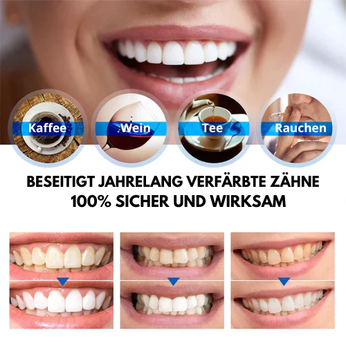 PearlSmile™ - Zahnaufhellungsstift (1+1 GRATIS)