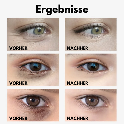 VEZE™ - Augencreme gegen Schwellungen (1+1 GRATIS)