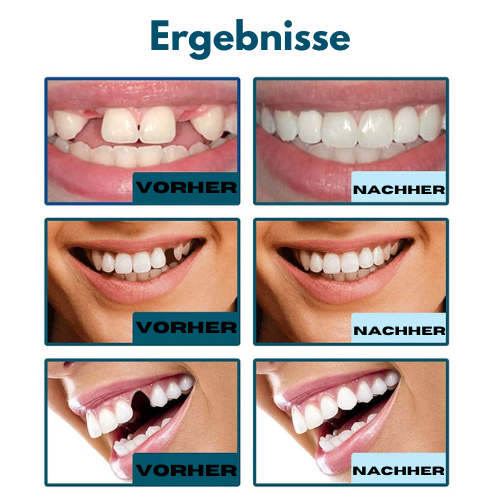 BrightSmile™ - aufklickbare Zahnoberflächen