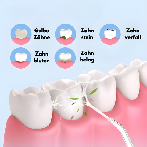 CleanSmile™ - Wasserflosser für die Mundhygiene