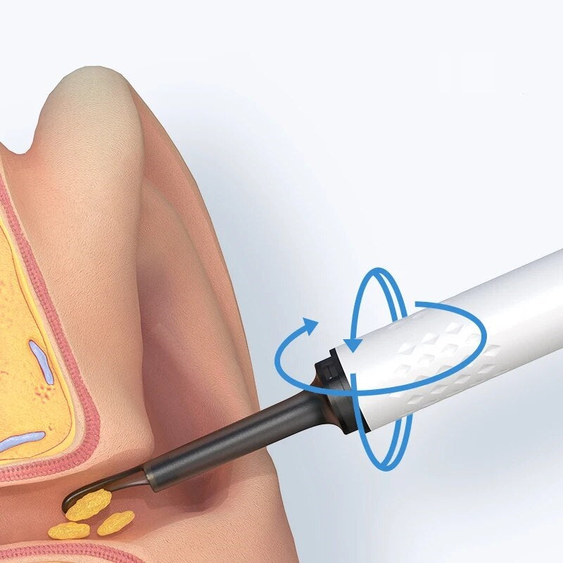 VistaClean™ - Ohrenschmalz-Entferner-Endoskop