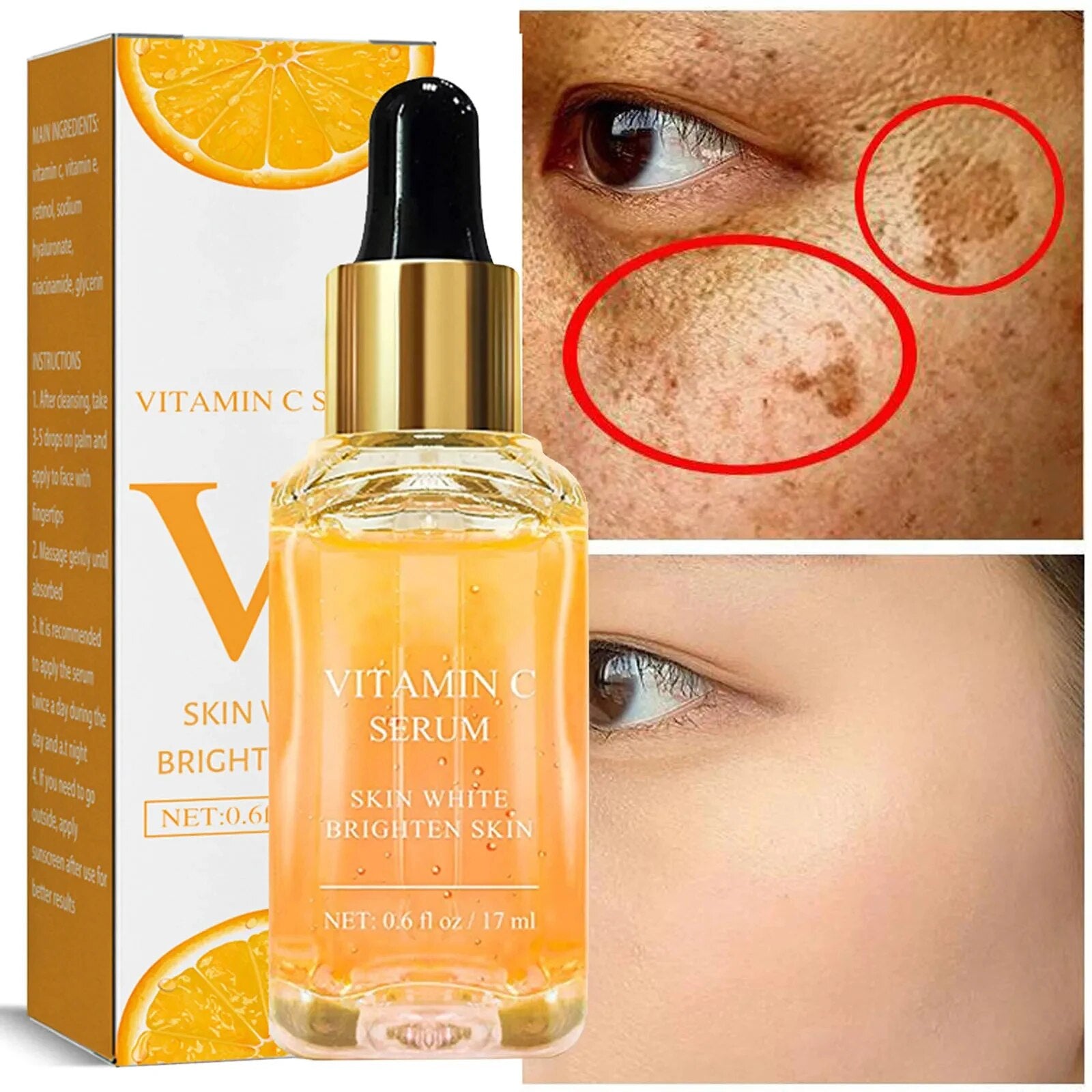 SpotVanish™ - Dunkle Flecken Serum (1+1 GRATIS)