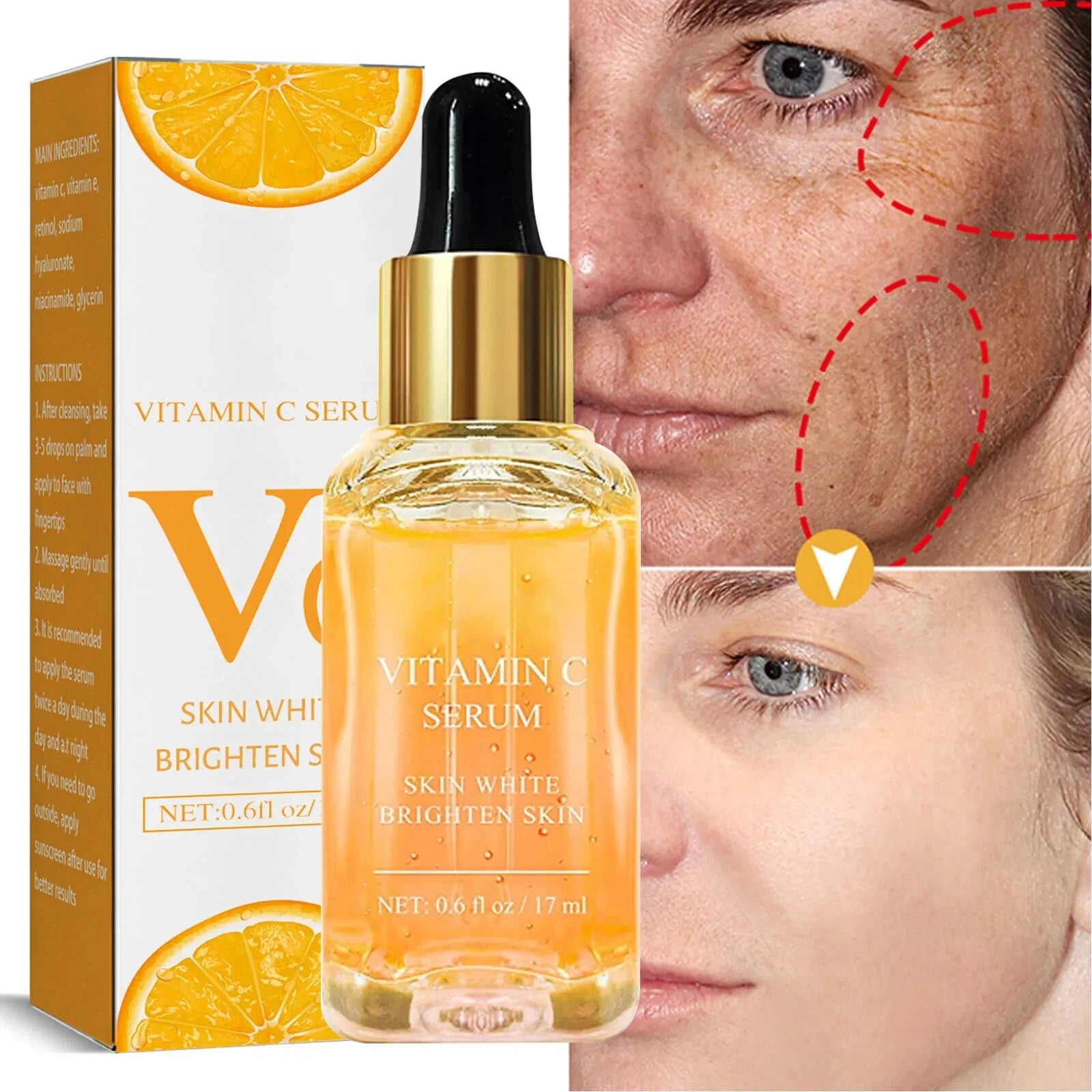 SpotVanish™ - Dunkle Flecken Serum (1+1 GRATIS)