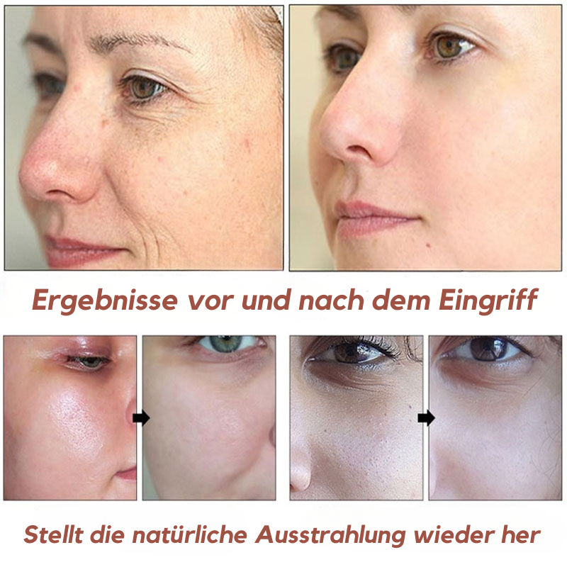 LuminEyes™ - Retinol Anti-Falten Augencreme (1+1 GRATIS)