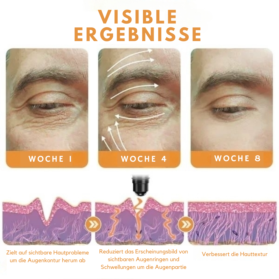 ActiveEyes™ Energetischer Augenroller