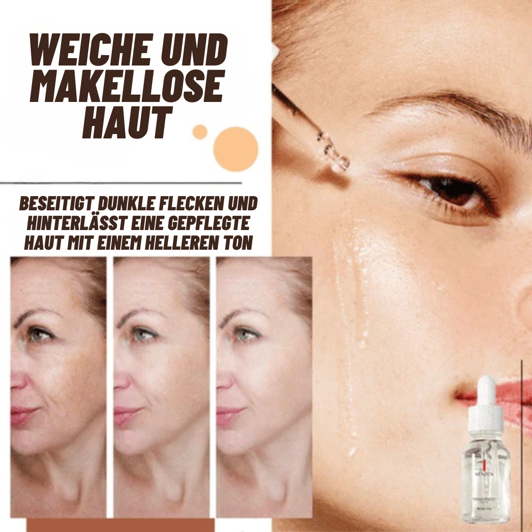 VENZEN™ Serum zur Korrektur dunkler Flecken (1+1 GRATIS)