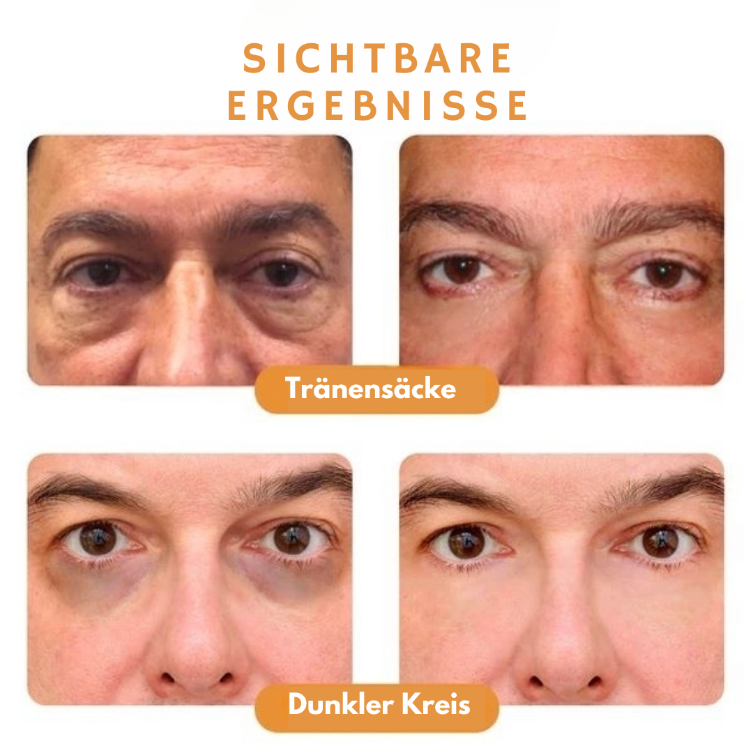 ActiveEyes™ Energetischer Augenroller