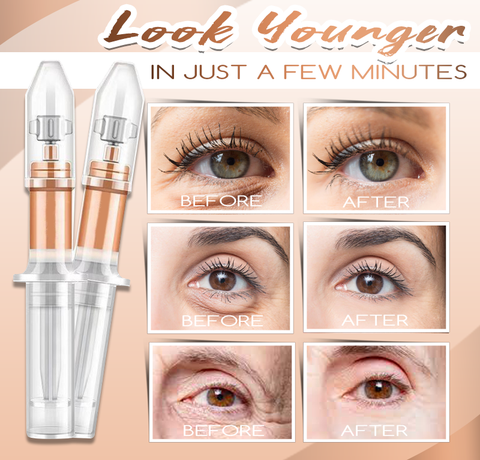 EyeBag Lift™ Anti-Augentaschen-Creme (2+2 GRATIS)