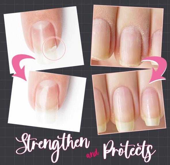 Nail Protect™ Nagelreparatur Protect Gel (1+1 GRATIS)