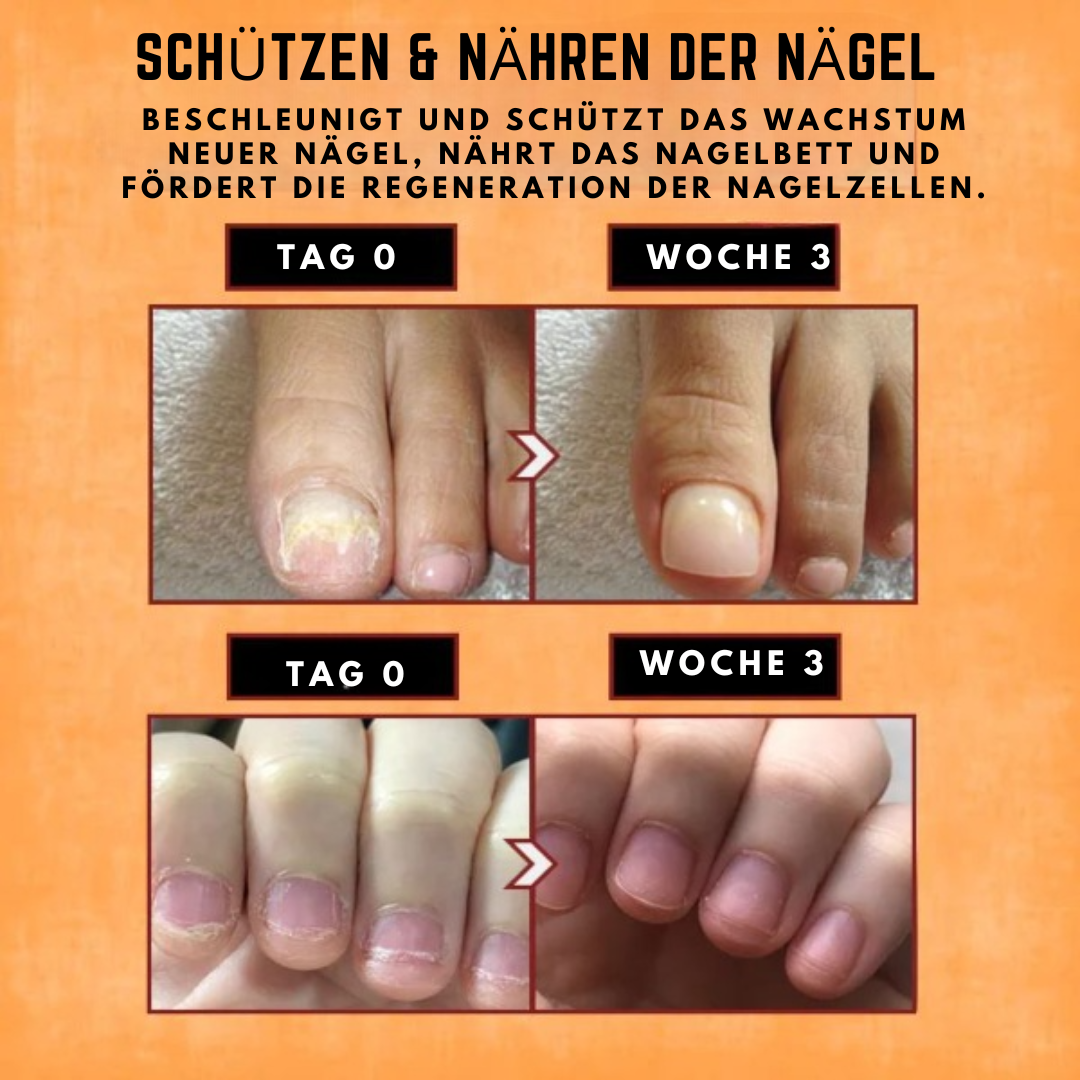 NailFix™ Reparaturserum für Nägel