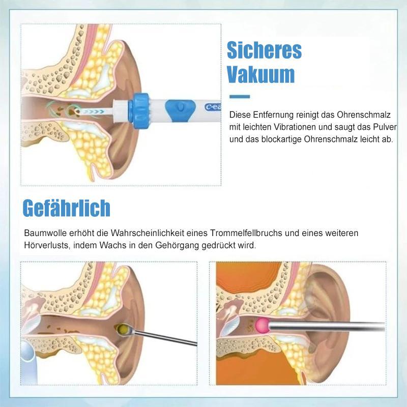 Ear Wax™ Ohrenschmalzentferner Staubsauger