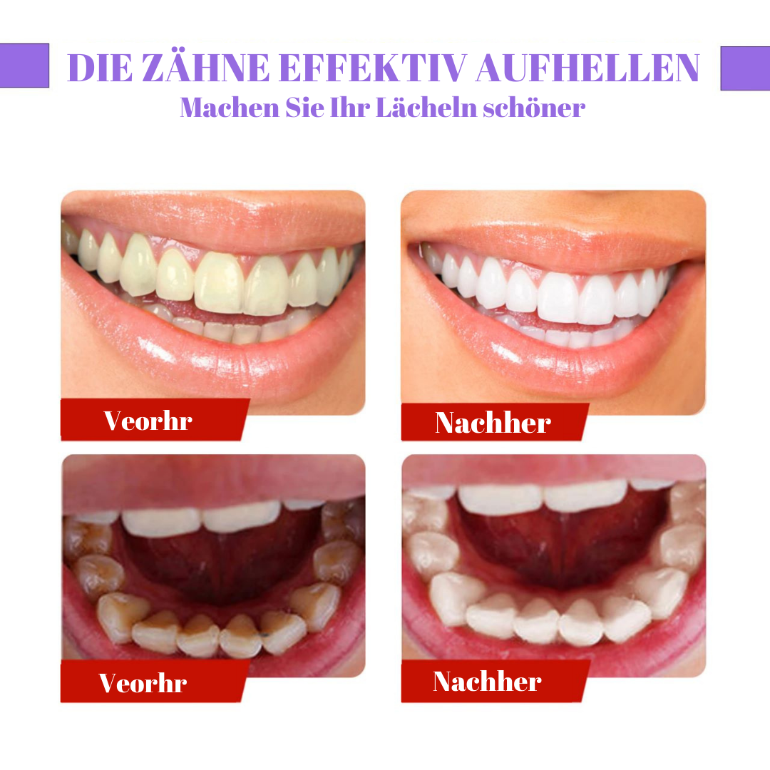 Lila Shine™️ Fortgeschrittenes Zahnweiß-Gel (1+1 GRATIS)