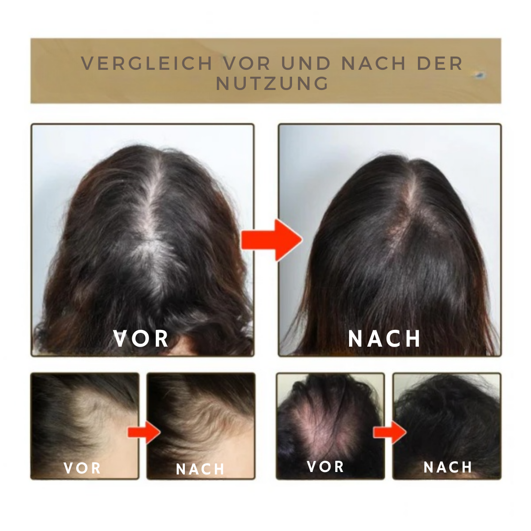 EELHOE™ Haare nachwachsen lassen Shampo (1+1 GRATIS)