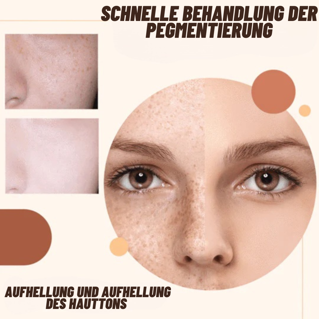 VENZEN™ Serum zur Korrektur dunkler Flecken (1+1 GRATIS)