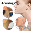 Acurrings™️ I Magnetische Therapie-Ohrringe (1+1 GRATIS)