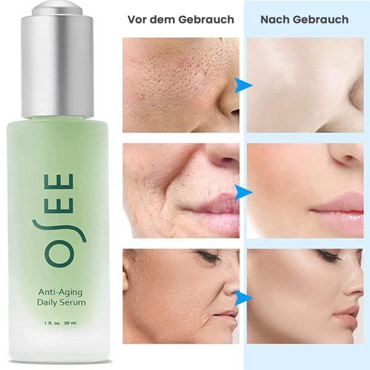 Osee™ - Anti Aging Serum (1+1 GRATIS)