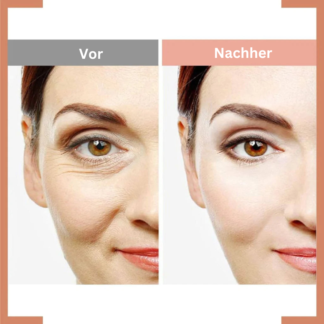 EyeBag Lift™ Anti-Augentaschen-Creme (2+2 GRATIS)