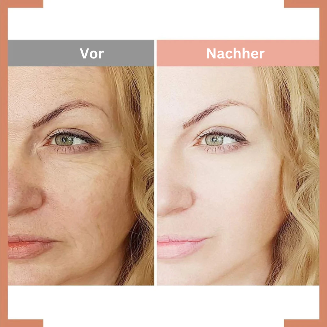 EyeBag Lift™ Anti-Augentaschen-Creme (2+2 GRATIS)