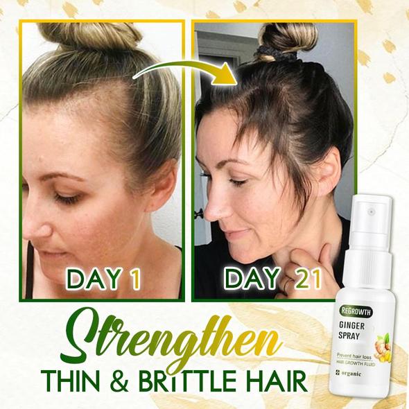 HairGrow™ - Nachwachsender Ingwer-Spray(1+1 GRATIS)