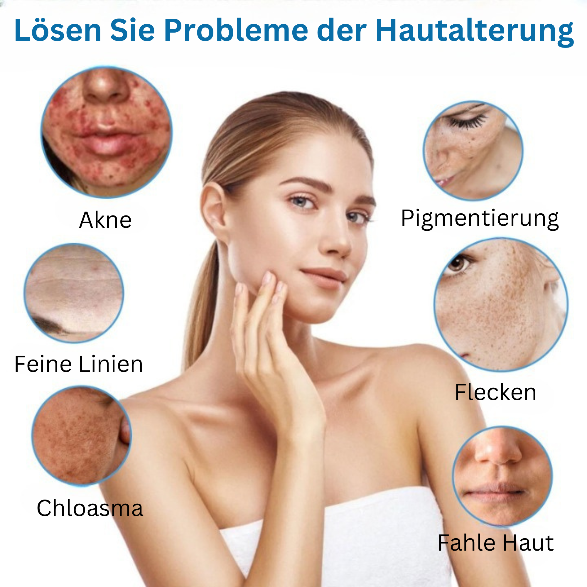 Eelhoe™️ I Lotion zur Behandlung von dunklen Flecken und Akne (1+1 GRATIS)