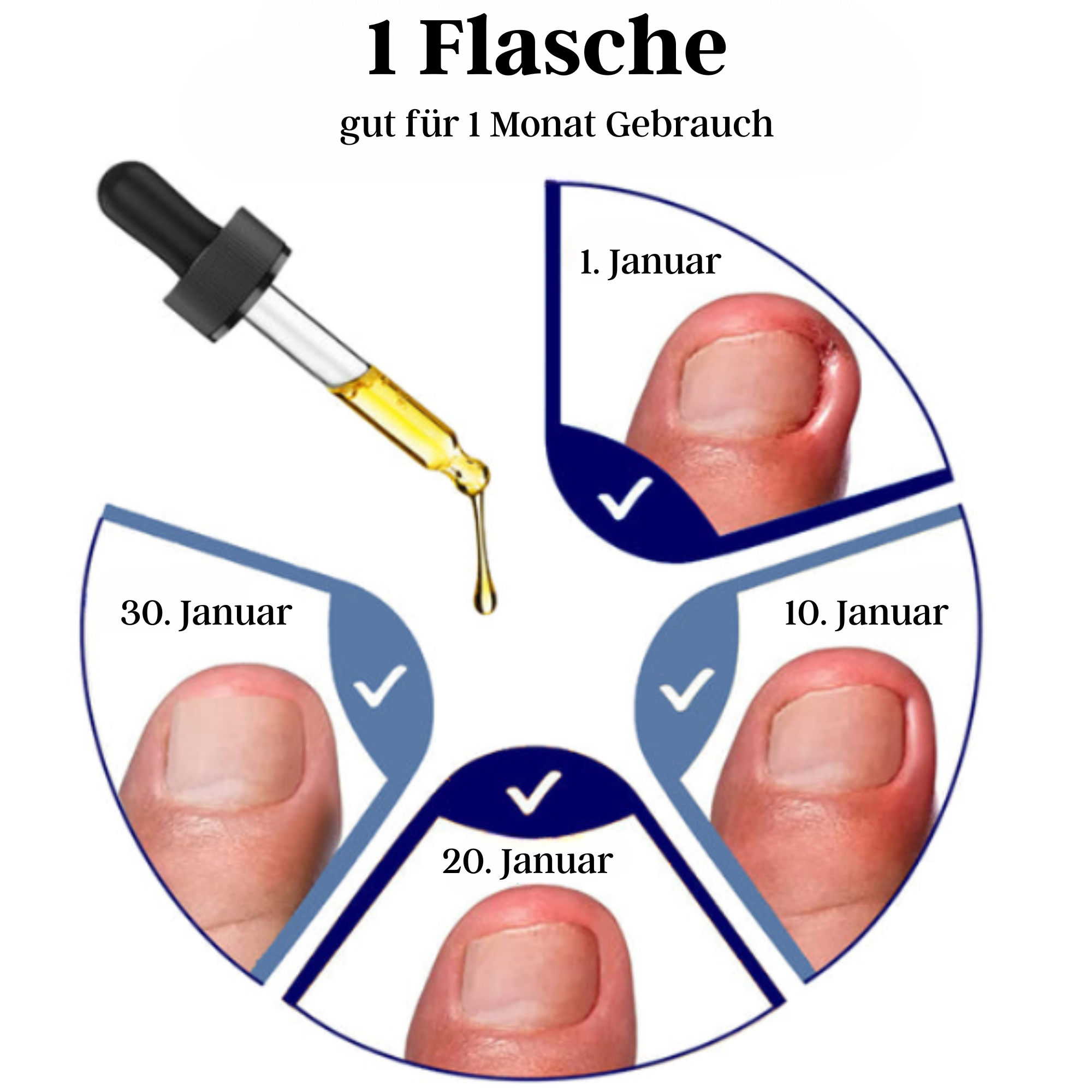 Jaysuing™️ I Anti-paronychie-Erleichterungsöl (1+1 GRATIS)