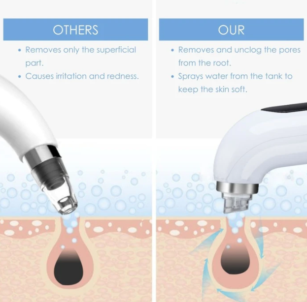 HydraBubble™ - Mitesser-Entferner