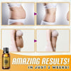 Health Serum™ Bauchdrainage Ingweröl