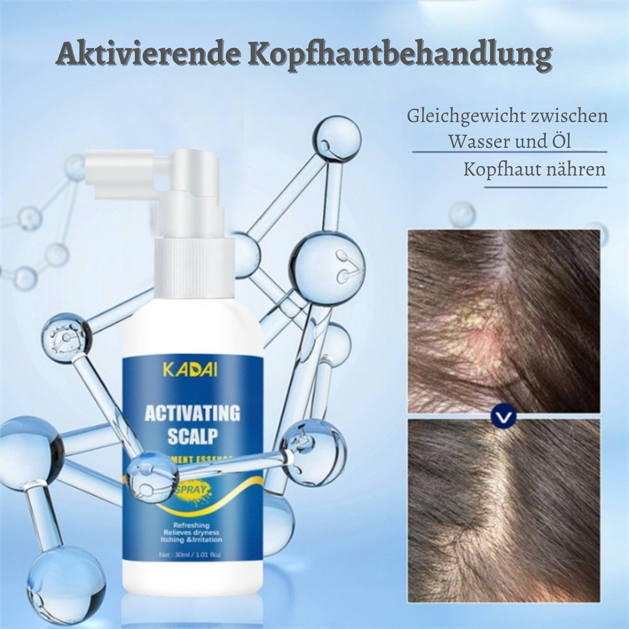 Kadai™️ I  Haarwachstumsspray