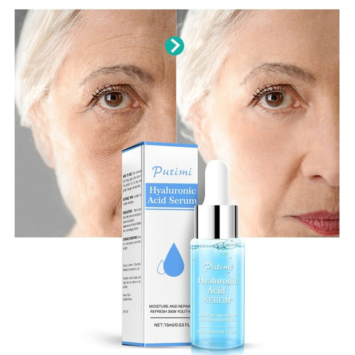Putimi™ - Hyaluronsäure Tiefen-Anti-Falten-Serum (1+1 GRATIS)