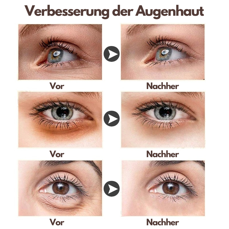 JoyPretty® - Multieffekt-Augencreme (1+1 GRATIS)